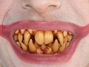 Adult Men's Pennywise Fang Teeth - It Halloween Costume Multi-Colored